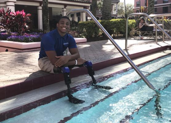 Teen dips prosthetic legs in pool