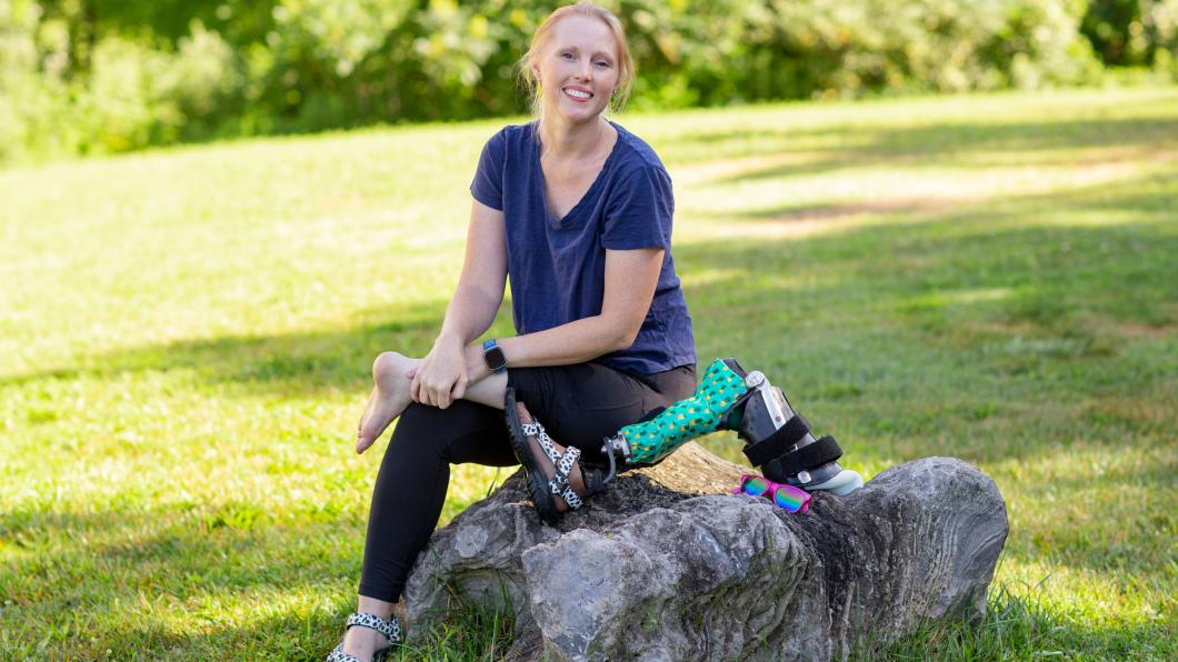 Woman with long blonde hair in park sitting on rock with a brightly coloured prosthetic leg