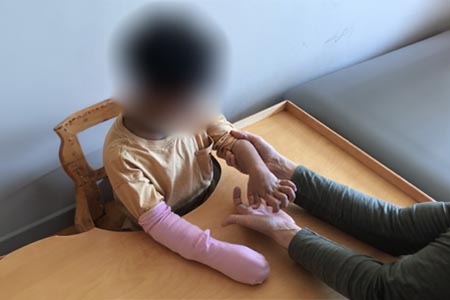 Tickle the palm/forearm with a feather/toy to encourage infant to rotate forearm to look for the source.