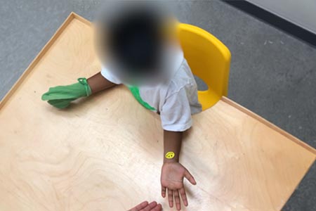Place a large bright sticker in infant’s palm or on the inner forearm, cue infant to turn palm upwards to see the sticker.