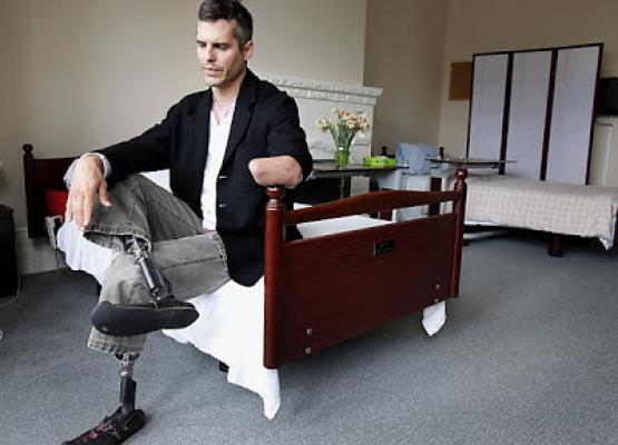 Amputee doc: We need to 'make room' for suffering