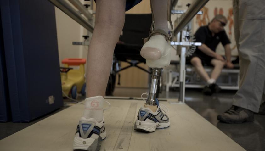 We treat clients who were born without a limb or have lost a limb to injury or health condition