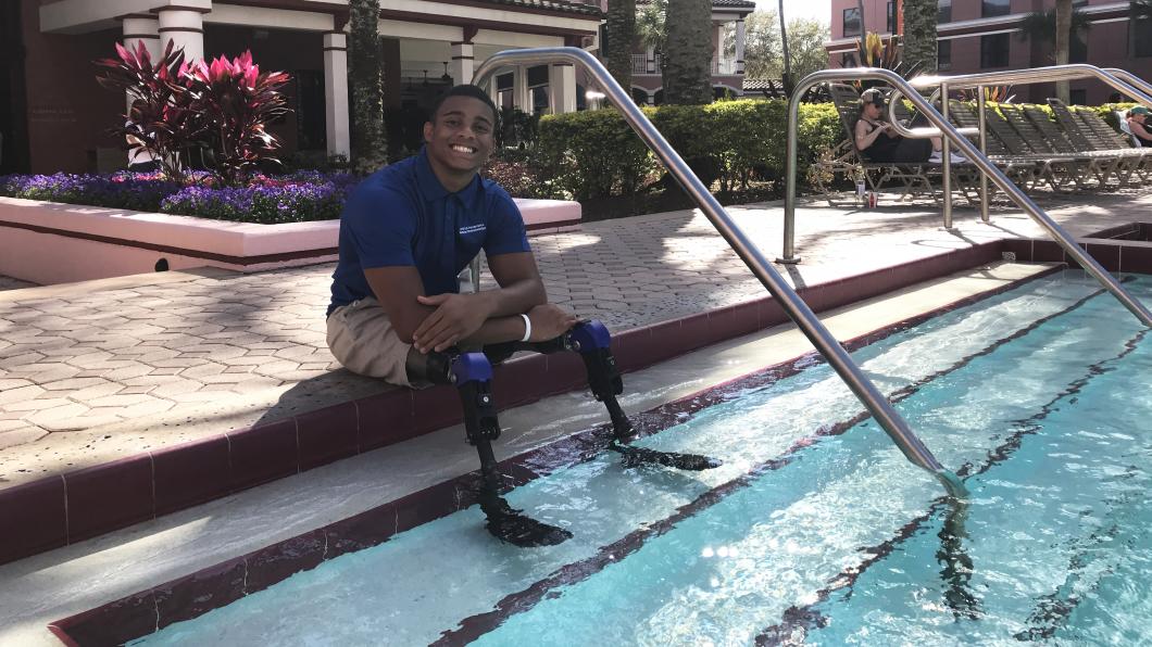 Teen dips prosthetic legs in pool