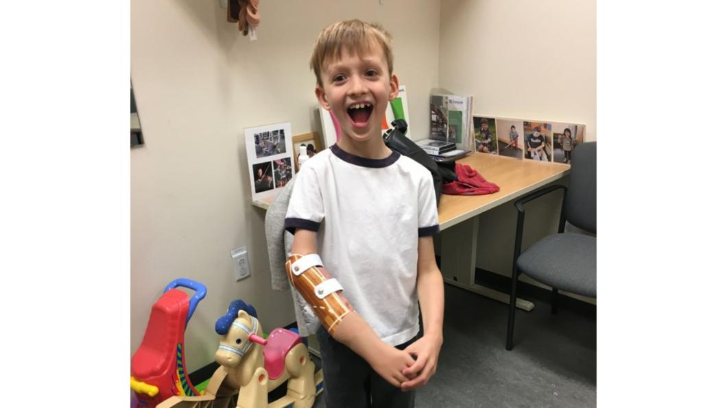 Nolen wearing his prosthetic for the first time. 