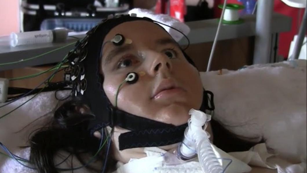 With mind-reading device, 'locked-in' people say they're happy