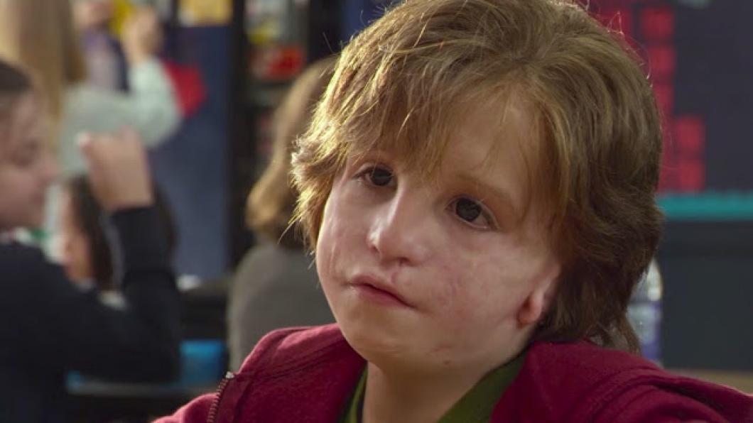 A mask doesn't belong in a film about courage to be who you are