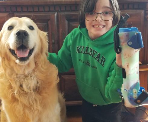 Lexi posing with her dog Cooper as she holds up her AFOs.