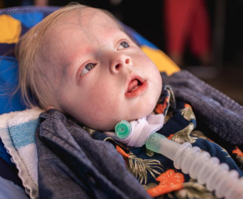 Young boy with tracheostomy tube lying in a chair facing upwards