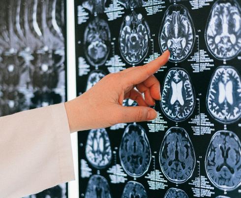 Image of brain scans being reviewed by health-care team member. Credit: Pexels.com Anna Shvets